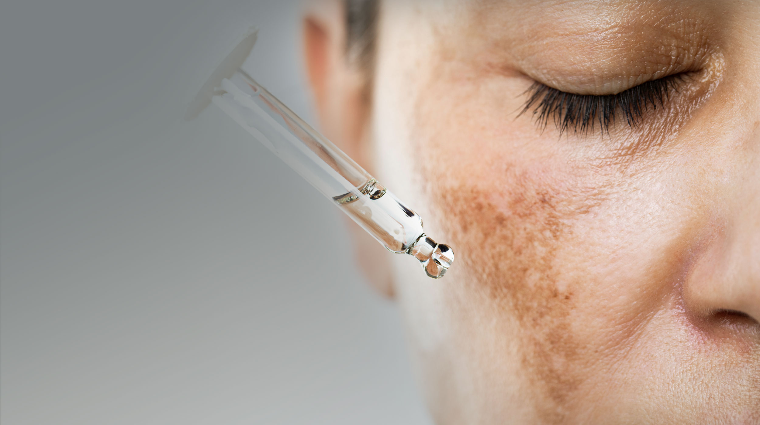 Close-up of a woman's face receiving a serum treatment