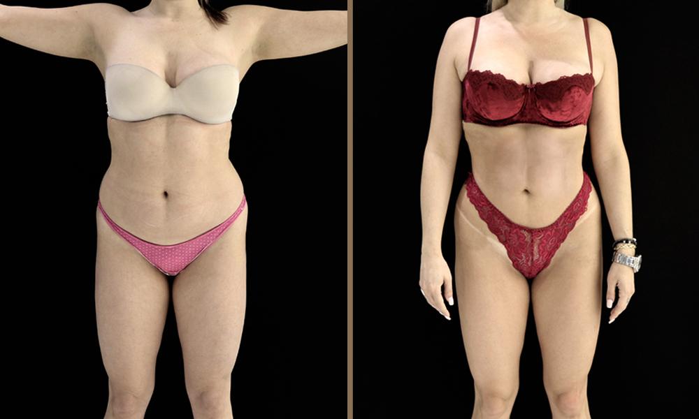 4D HD_ 005 woman