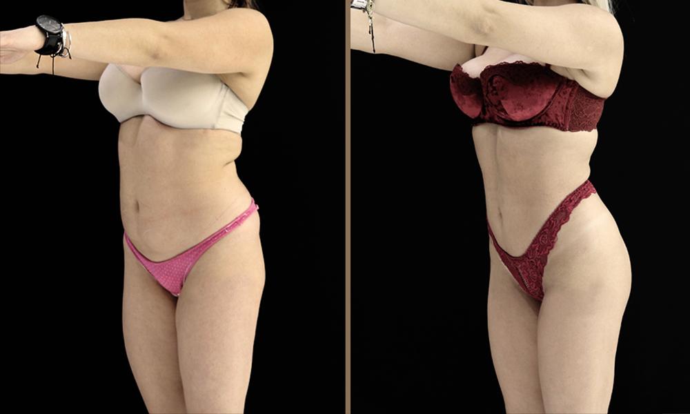 4D HD_ 006 woman