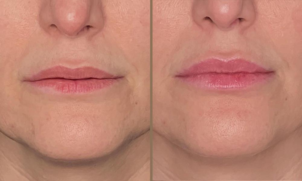 3D LIPS 6