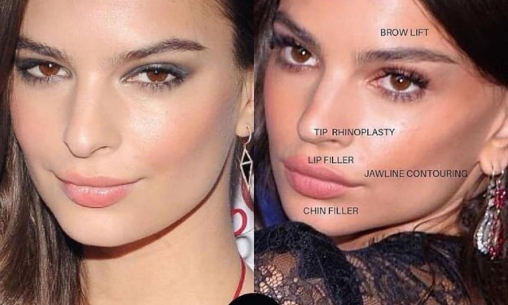 Beautification: Διαγωνισμός για την πιο δημοφιλή εμπειρία περιποίησης!