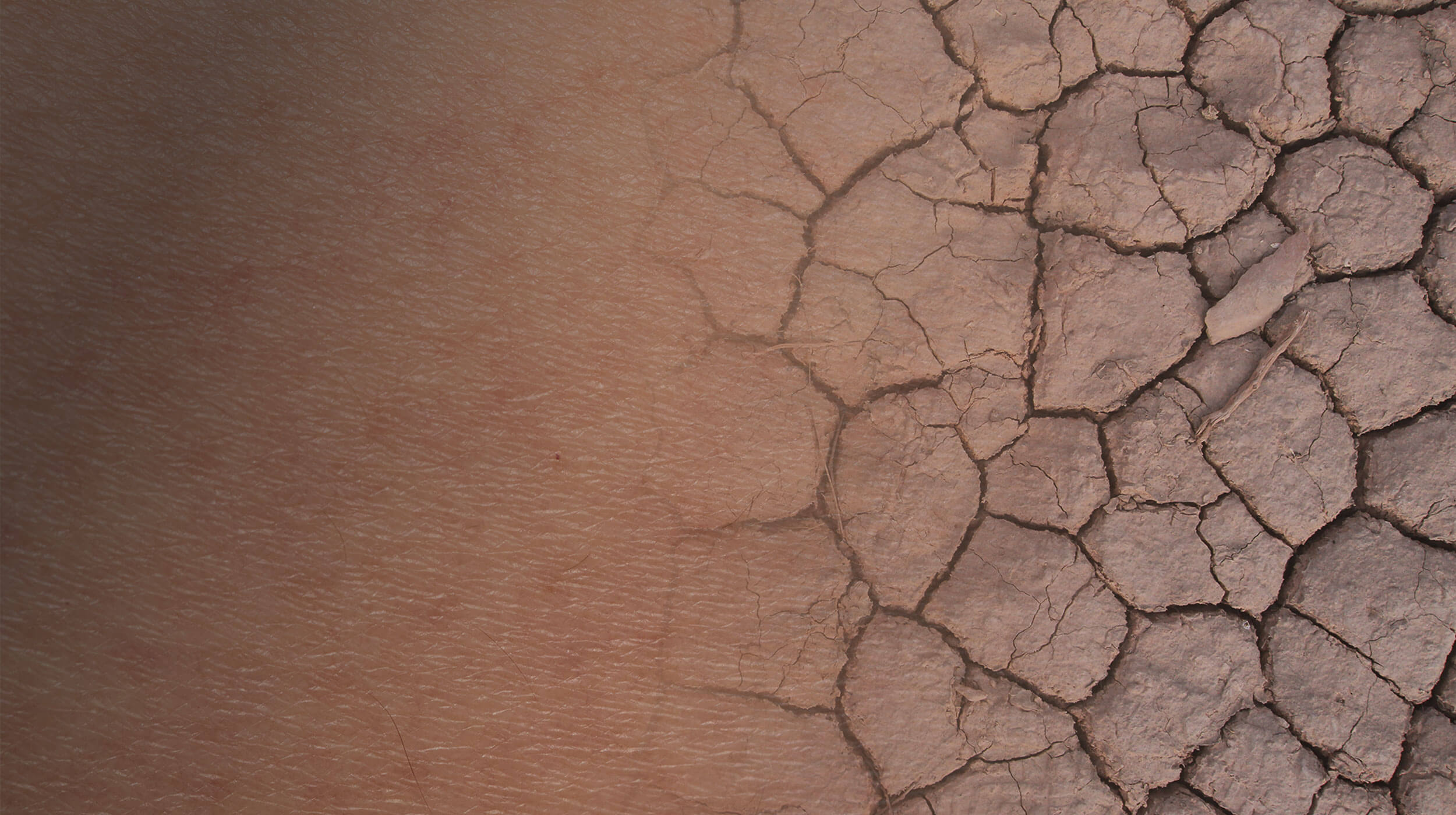 Αφυδάτωση Δέρματος: