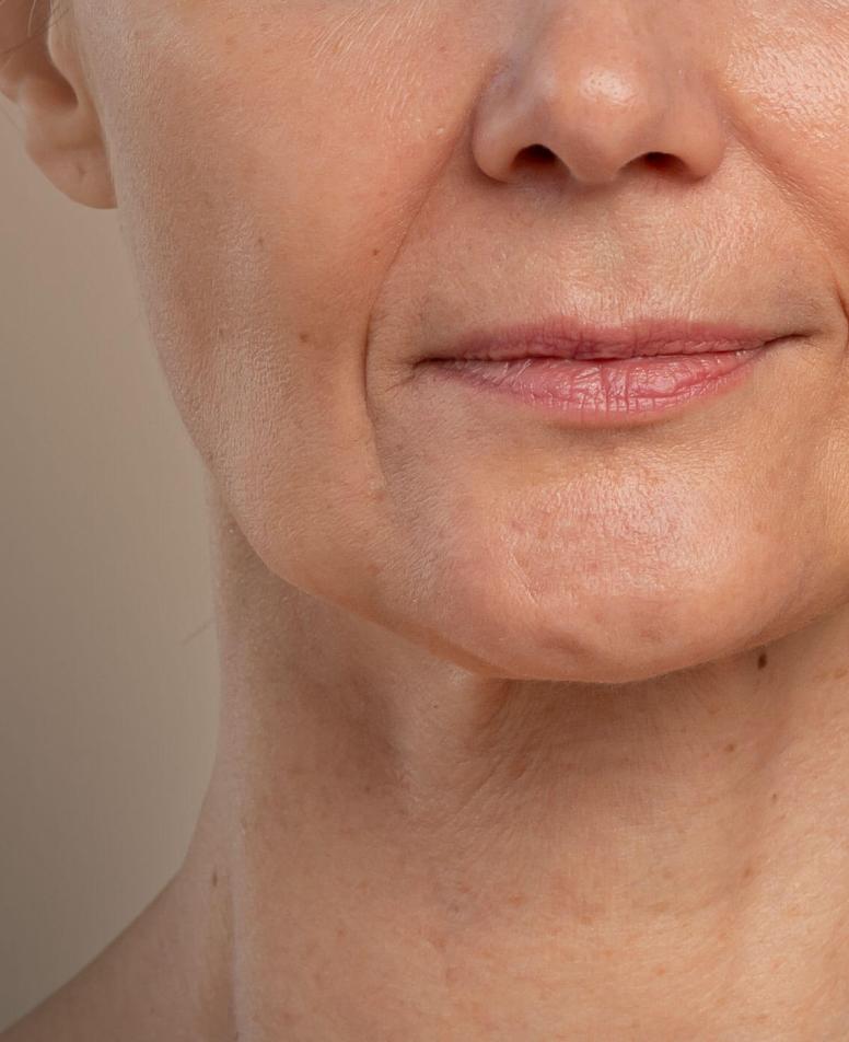 apolia-elastikotitas