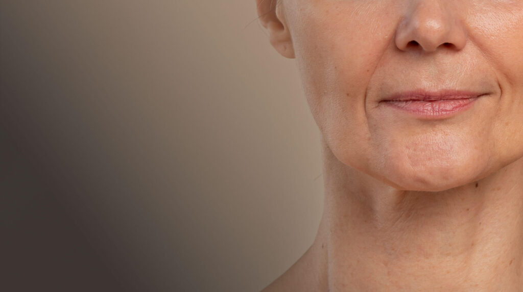 Loss of skin elasticity