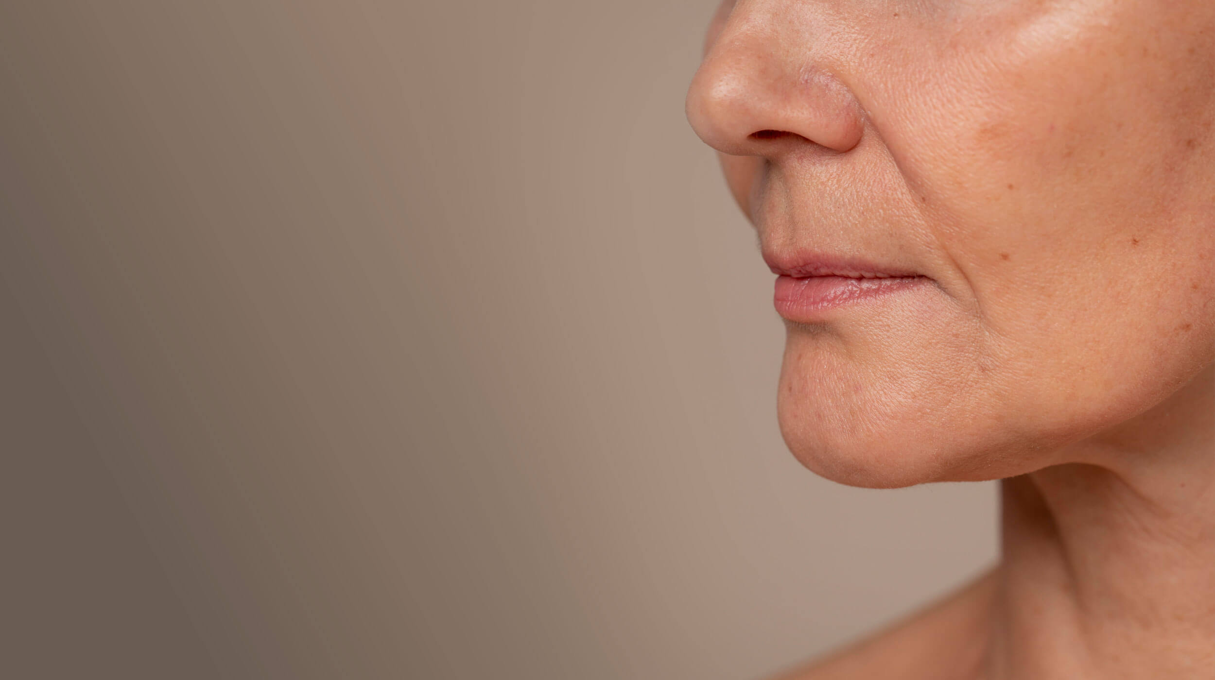 Απώλεια Όγκου στο δέρμα