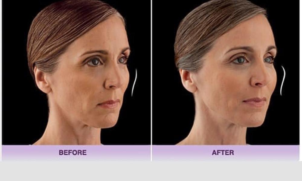 blog_juvedermvoluma_ba