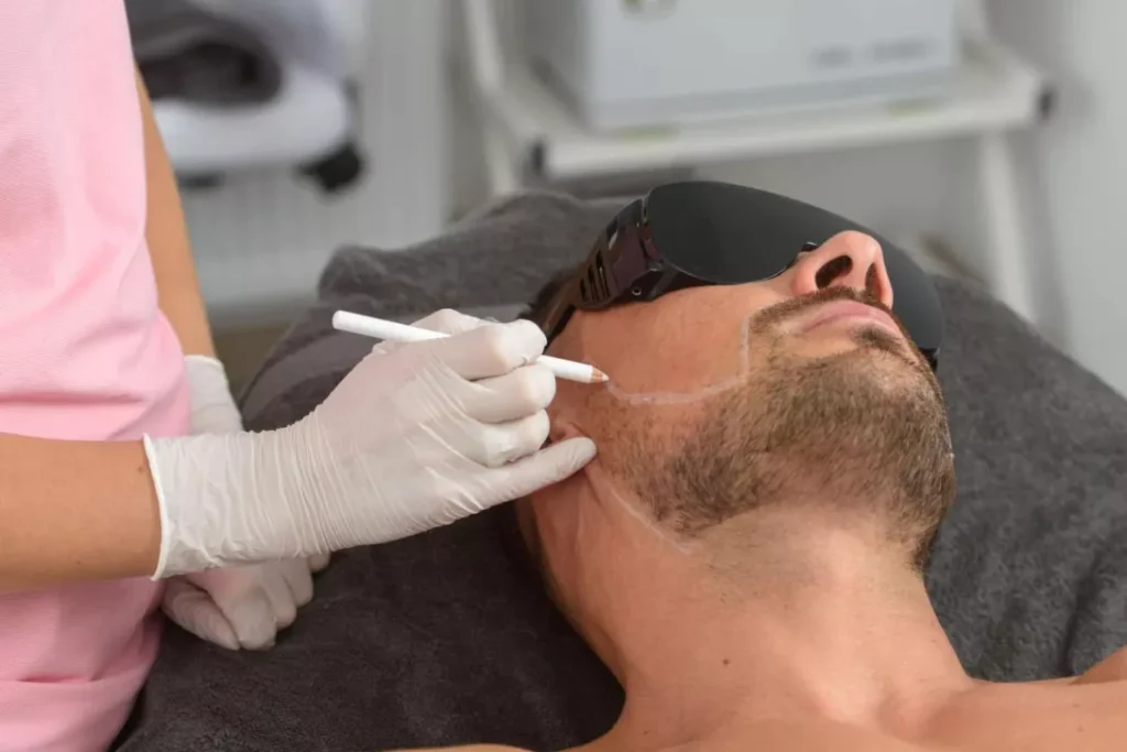 Laser Hair Removal with Alexandrite Arion II
