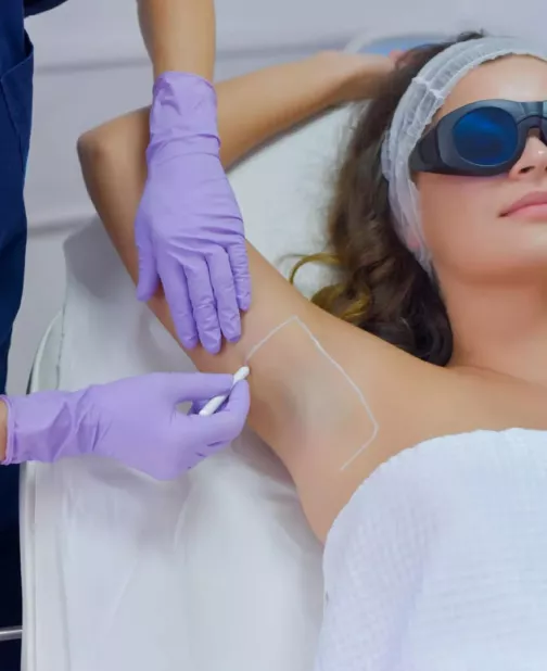 Laser Hair Removal with Alexandrite Arion II
