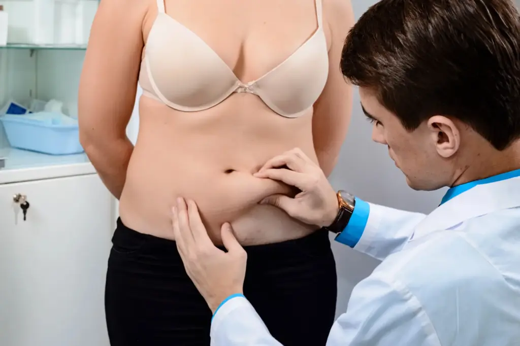 Who are suitable candidates for liposuction?